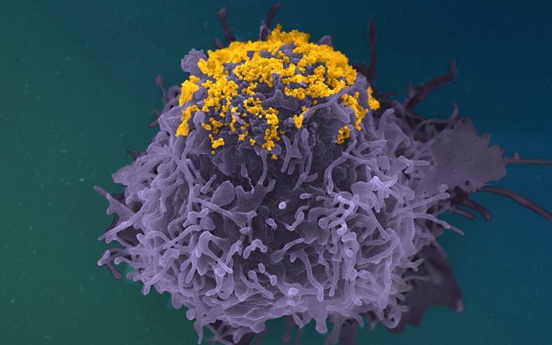 [VIH] Découverte d’une nouvelle fonction des anticorps contre le virus