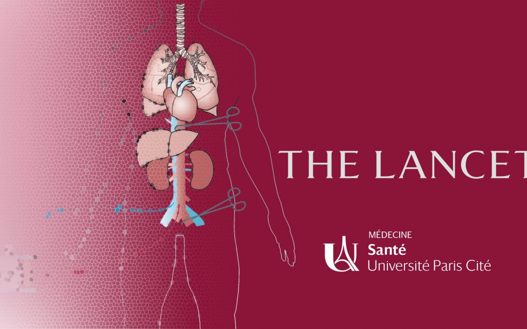 THE LANCET SERIE TRANSPLANTATION