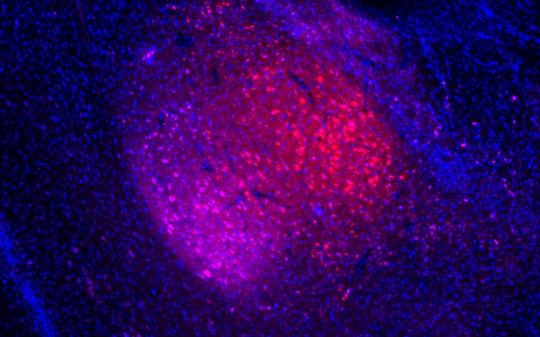 Dépression : un dysfonctionnement de certains neurones de l’amygdale serait à l’origine de la perception négative de l’environnement