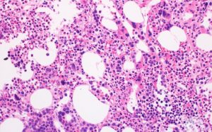 FHU – CARE – Journal Club d’Immunologie Transdisciplinaire