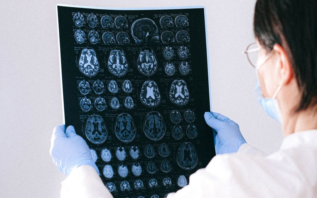 [Journée Mondiale de la Santé Mentale] IHM Neurosciences et cognition : mieux comprendre le cerveau pour mieux le préserver