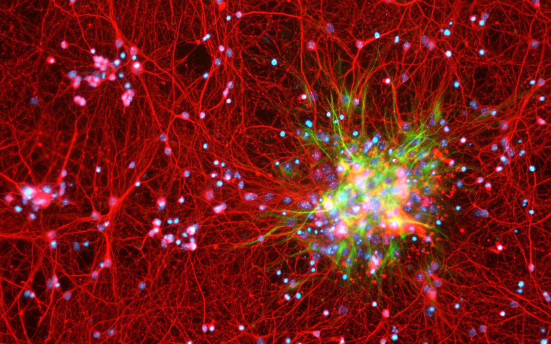 Ces cellules du cerveau qui pourraient aider à lutter contre l’obésité