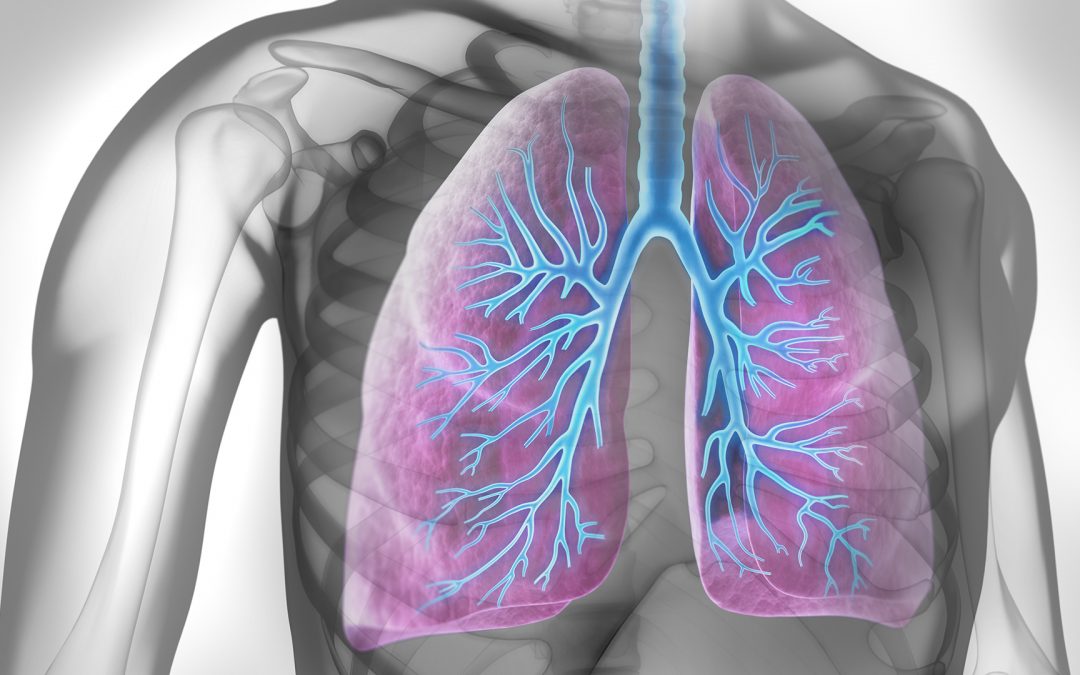 Effets précoces de l’association elexacaftor-tezacaftor-ivacaftor chez les patients atteints de mucoviscidose et de maladie pulmonaire sévère