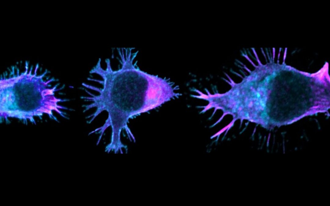 Cancer du côlon : comment la mutation du gène APC perturbe la migration des lymphocytes