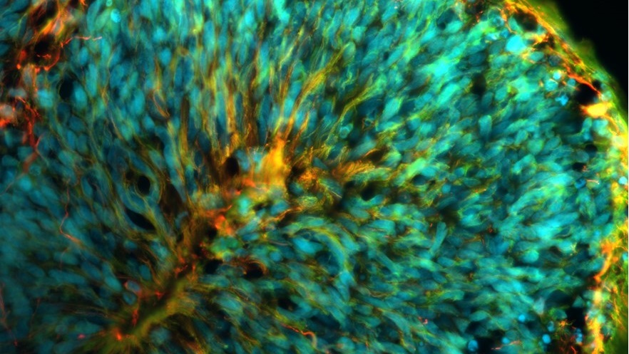 Maladies du développement du cerveau : des organoïdes cérébraux pour sonder le rôle des réponses au stress cellulaire
