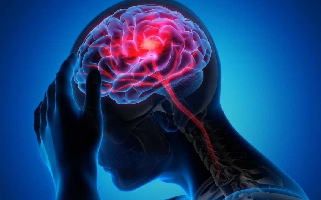 Prédire les AVC grâce à un système basé sur l’intelligence artificielle
